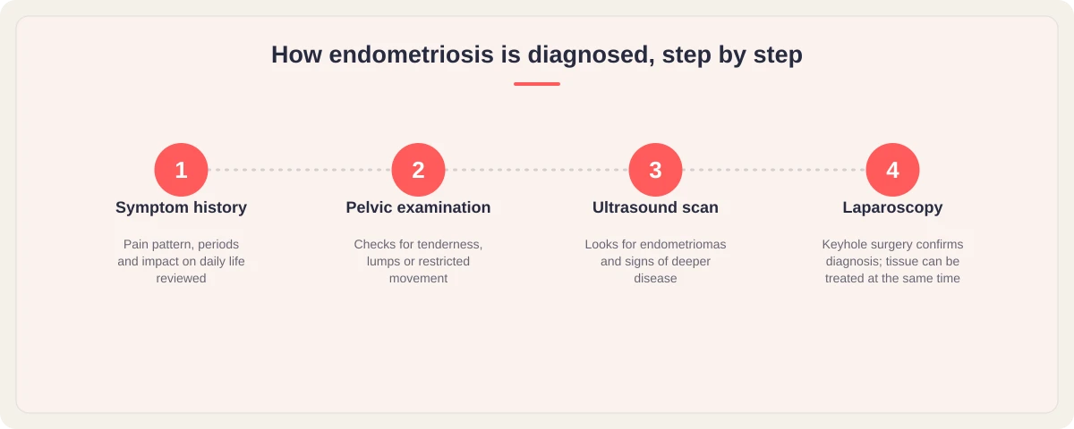 Four-step graphic: symptom history, pelvic examination, ultrasound scan, laparoscopy